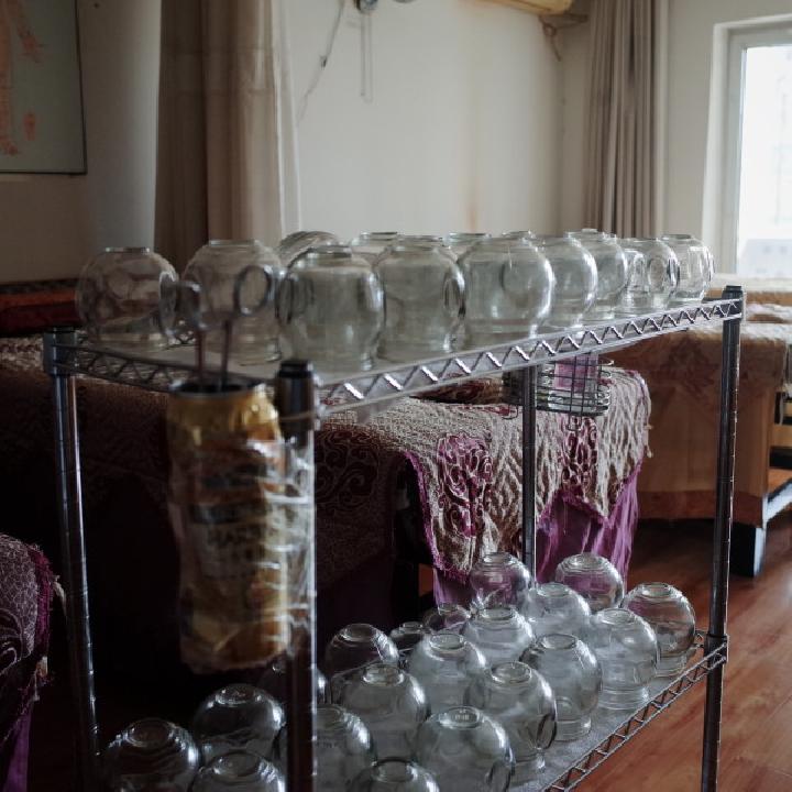 拔罐的禁忌和注意事项拔罐多久一次合适