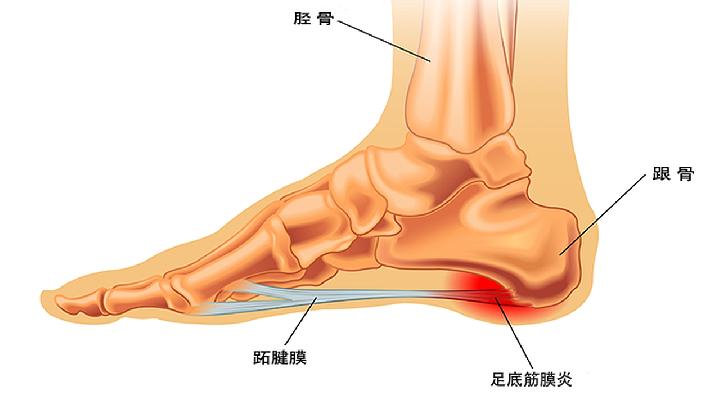 孩子脚心发热是怎么回事