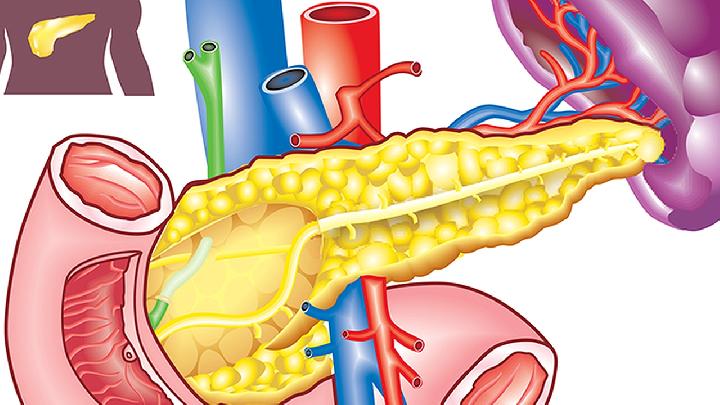 胰腺炎的饮食禁忌和保养