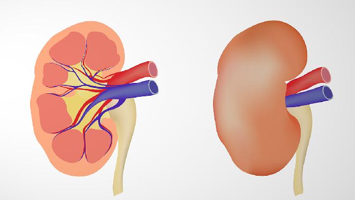 钙乳症性肾囊肿是怎么回事，怎么办