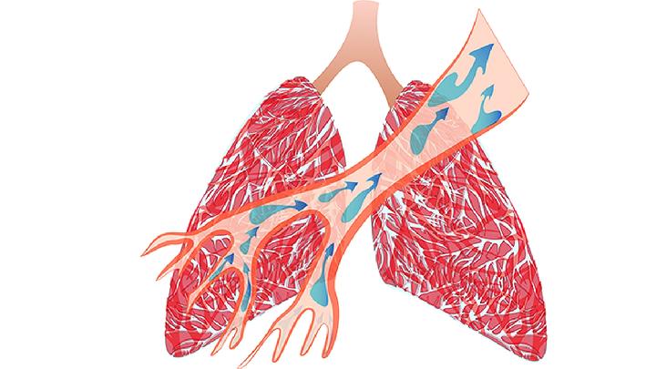 支气管扩张怎样锻炼肺功能