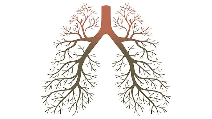 肺癌晚期死前4個信號