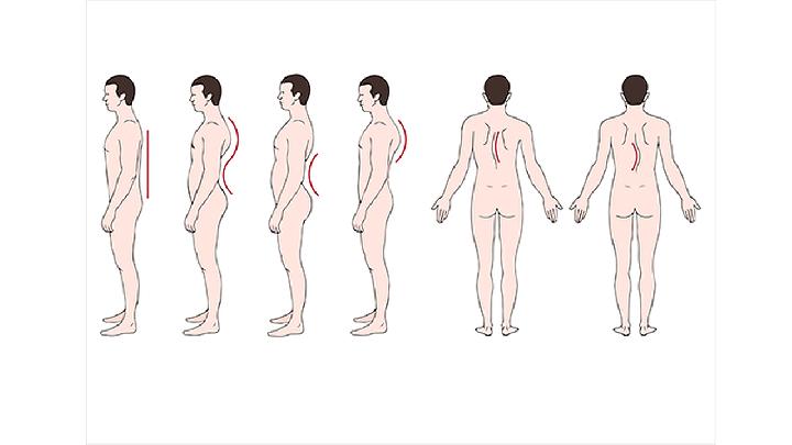 強(qiáng)直性脊柱炎腳后跟疼的癥狀