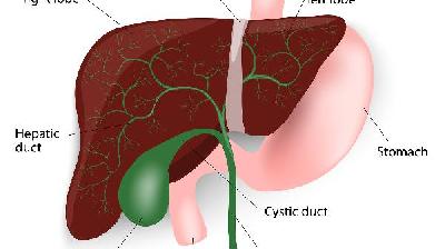 b超肝囊肿怎么了