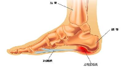 跟腱炎没有办法锻炼吗？