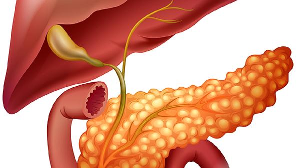 胰腺脂肪化怎么了