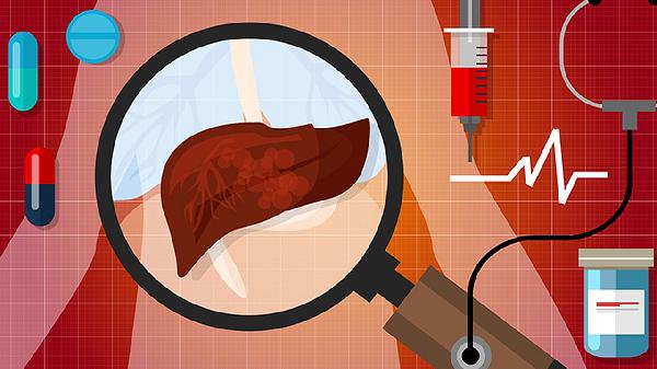 肝纤维化是抽血还是b超