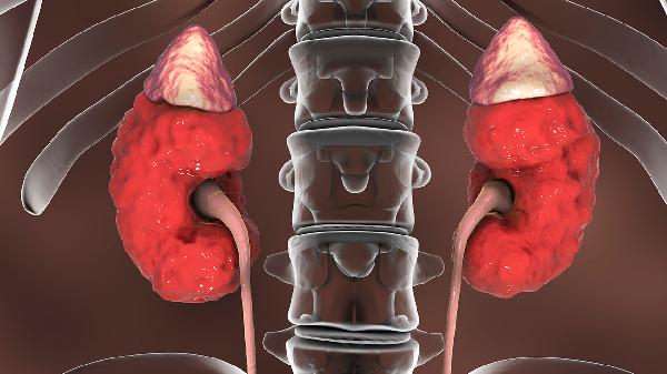 慢性腎炎與慢性腎衰竭的區(qū)別