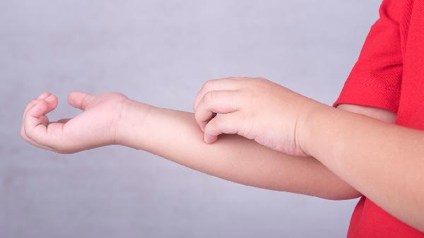 男性生殖器疱疹容易治疗吗