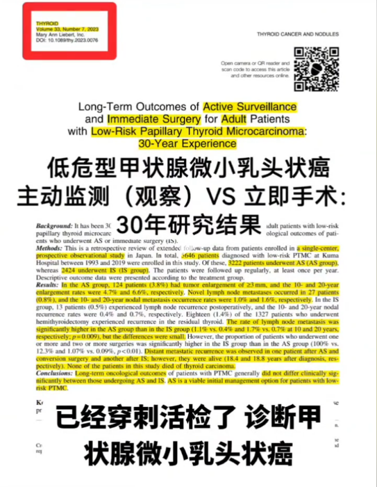 甲状腺癌可以只观察不手术了？米诺娃朱精强教授说都是误会！