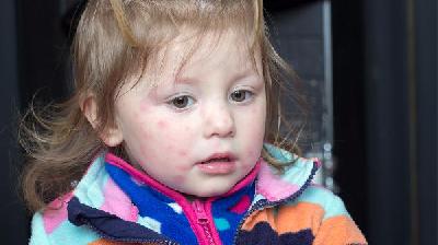 尿有点发红是怎么回事