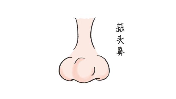 蒜头鼻怎么自己改善