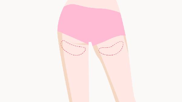 深蹲会不会瘦大腿