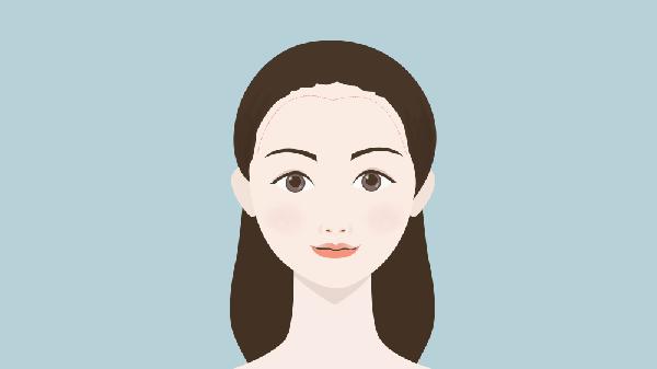 做改發(fā)際線手術(shù)多少錢？