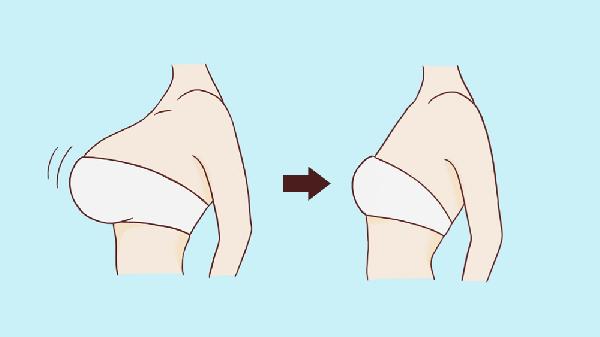 做半側(cè)切除法乳頭縮小過程是怎樣的