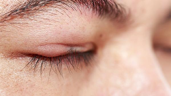 脸不对称如何改善？一文解析