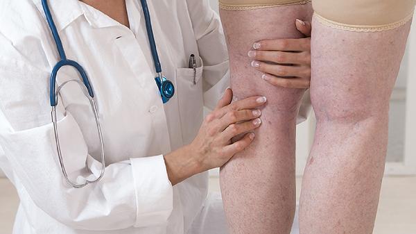 大腿外侧拍打出黑青硬疙瘩