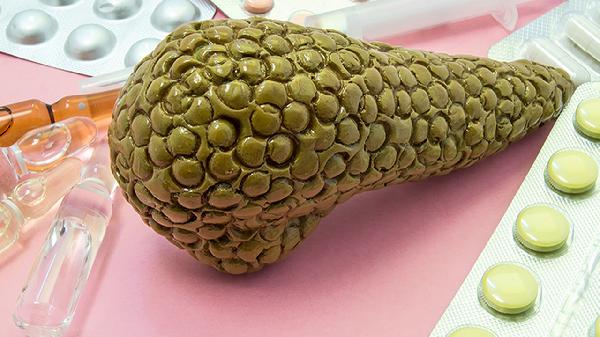 肝钙化是什么？了解这一现象的含义