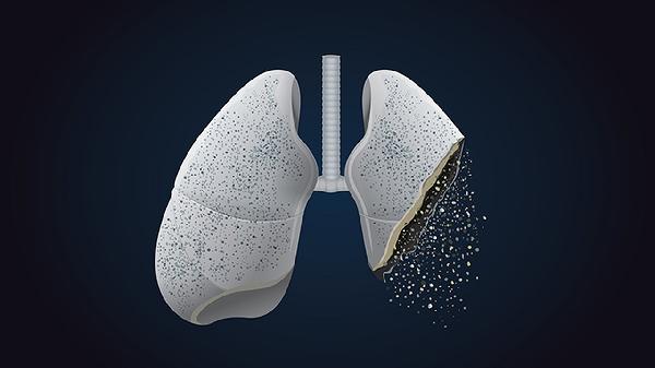 肺积液和肺积水一样吗