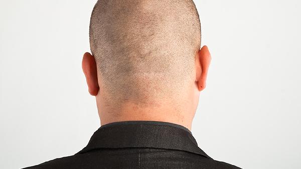 颈部酸痛看什么科