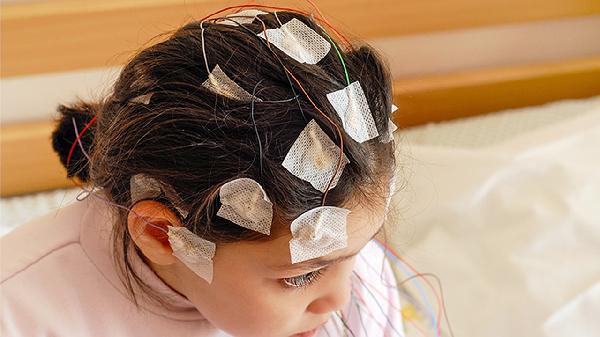 孩子神经性尿频3年了
