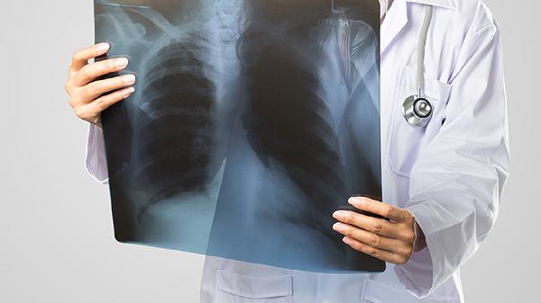 肺大疱胸腔镜怎么手术