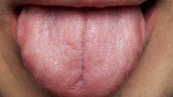 舌甲状腺分为哪几种