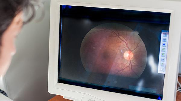 头上长的虱子的诊断标准