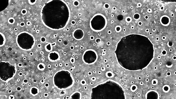 麻风病不知道疼吗