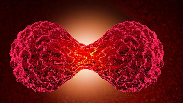 颅内动脉瘤的产生原因有