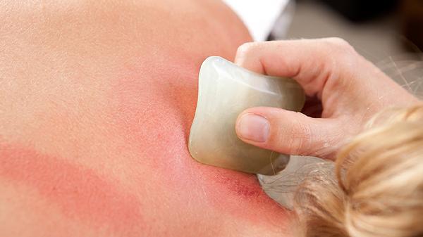 慢性心功能不全急性加重护理查房