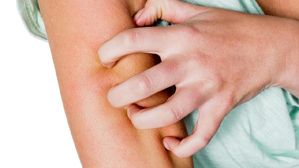 珍珠丘疹激光多少钱