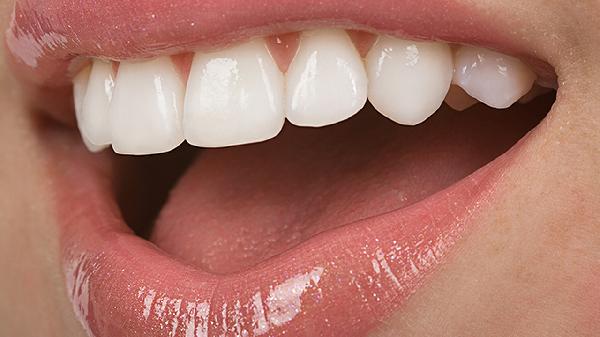 做烤瓷牙補(bǔ)牙費(fèi)用
