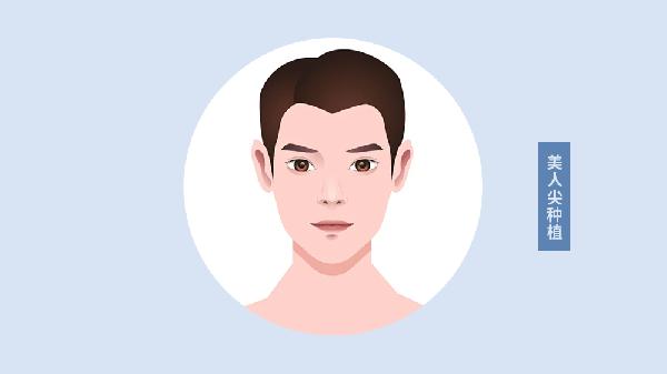 做美人尖種植價格是多少