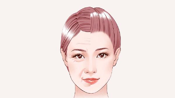 做眼瞼松弛修復(fù)的步驟及注意事項(xiàng)