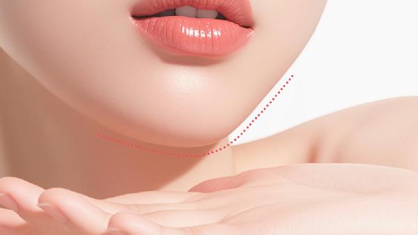 膨體墊下巴手術(shù)術(shù)后護(hù)理？