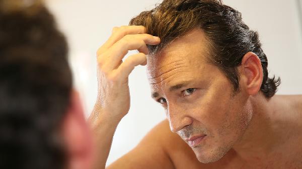 男士预防脱发的食物