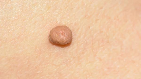 吃什么讓皮膚變得更好