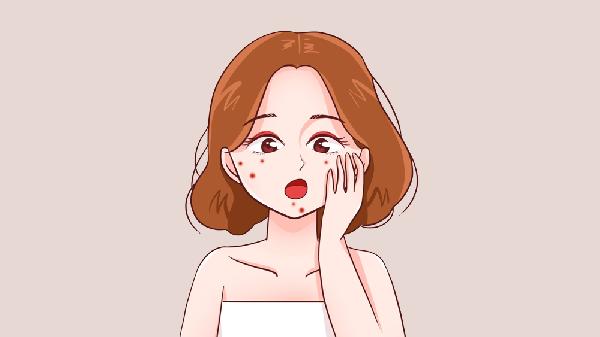 姨妈期长痘痘怎么调理
