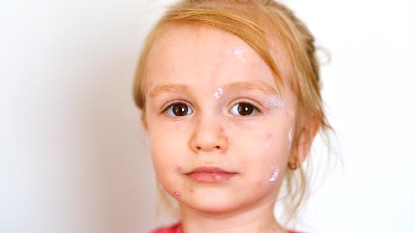 保养皮肤不能吃的食物