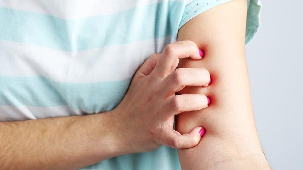 怎样才能舒缓皮肤瘙痒症