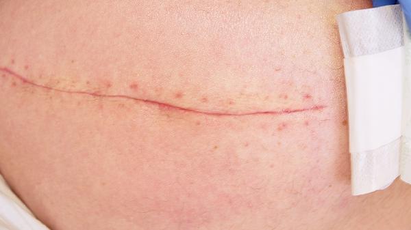 被褥怎么消毒和清洗