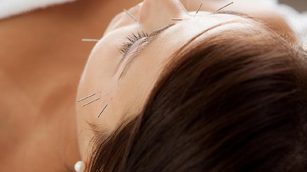 偏瘫手指屈伸不利的针灸方法