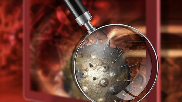 肾上腺肿瘤术后会不会复活