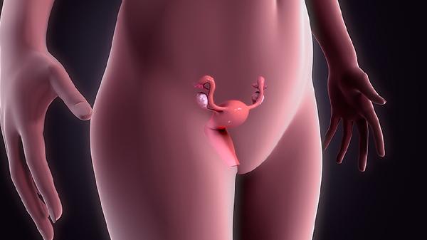 子宫息肉从哪里开刀 详述子宫息肉的手术过程
