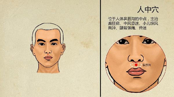 斑秃看中医好又或者是西医好