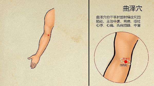 中医对腰间盘突出的辨证论治