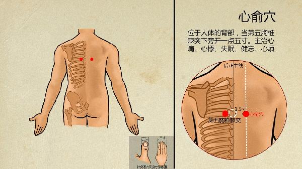斜方肌富贵包怎么消除中医按摩