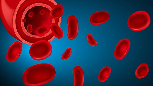 下肢动脉硬化怎么锻炼身体