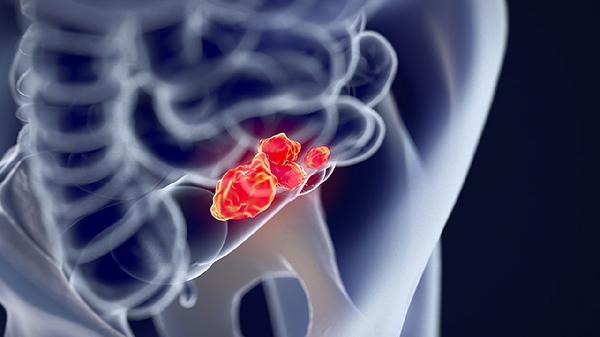 前庭大腺囊肿特别痒怎么止痒